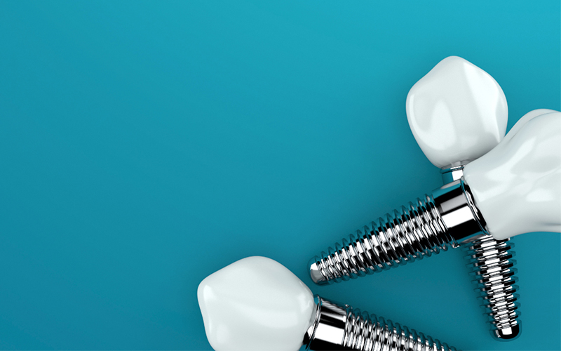 Dental implants in Kingston seasonal recovery guide by Greenwood Park Dentistry
